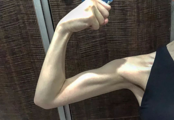 抖音女友臂是什么 长什么样介绍
