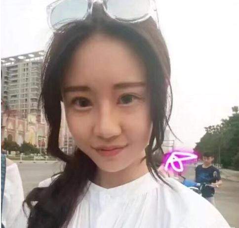抖音温婉整容前图片一览 温婉整过容吗